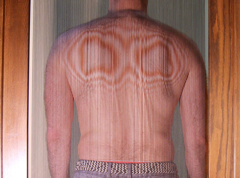 Contour analysis in clinic